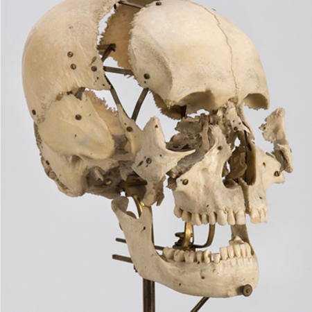 Mounted Beauchene skull