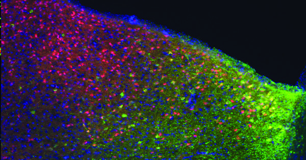 Image of threat-sensing neurons
