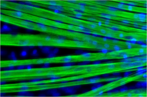 muscle fibers grown in the lab