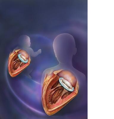 child to adult heart image