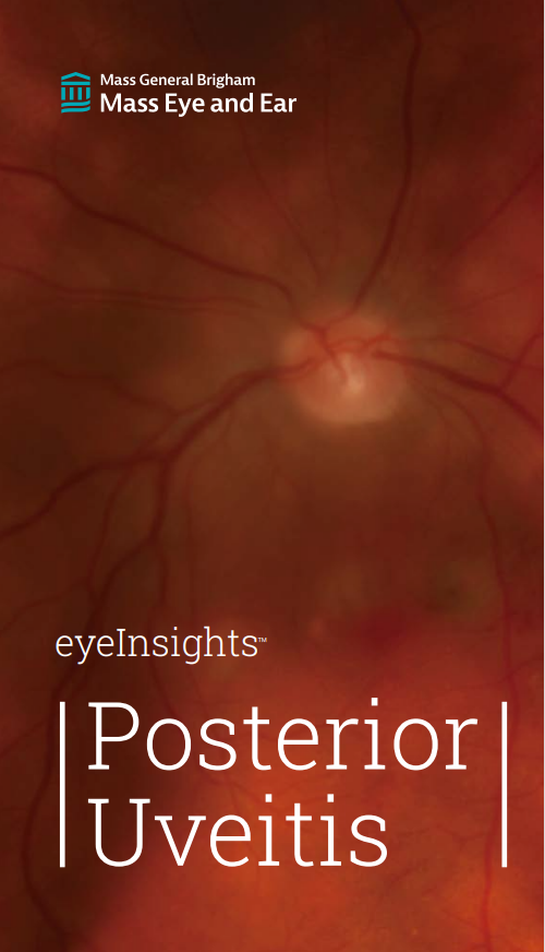 Eye Insights 13
