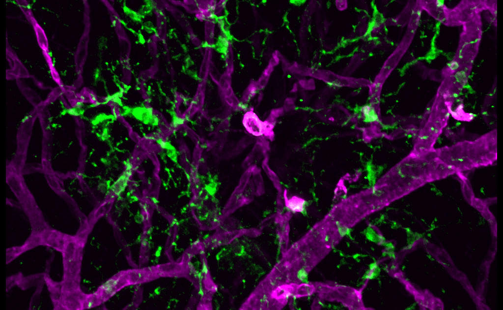photo of microglia in the retina