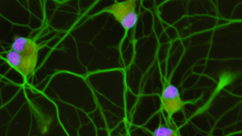 Scientific image of human stem-cell-derived motor neurons, c. Joseph Klim