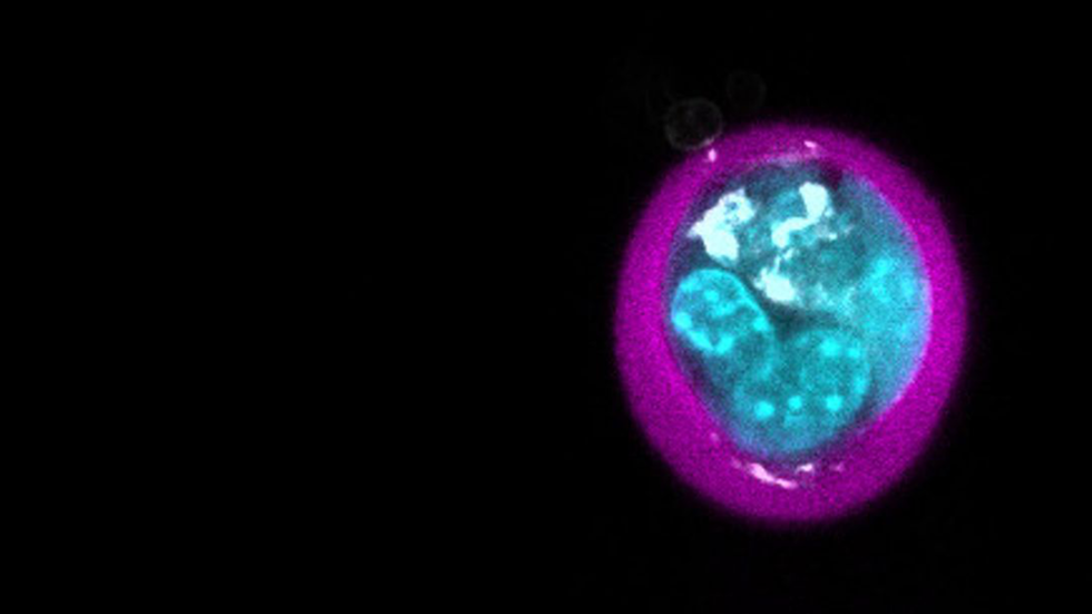Mesenchymal stem cells encapsulated in microgel.