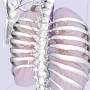 RSNA News:  Image-guided Video-assisted Surgery Helps Remove Small Lung Masses